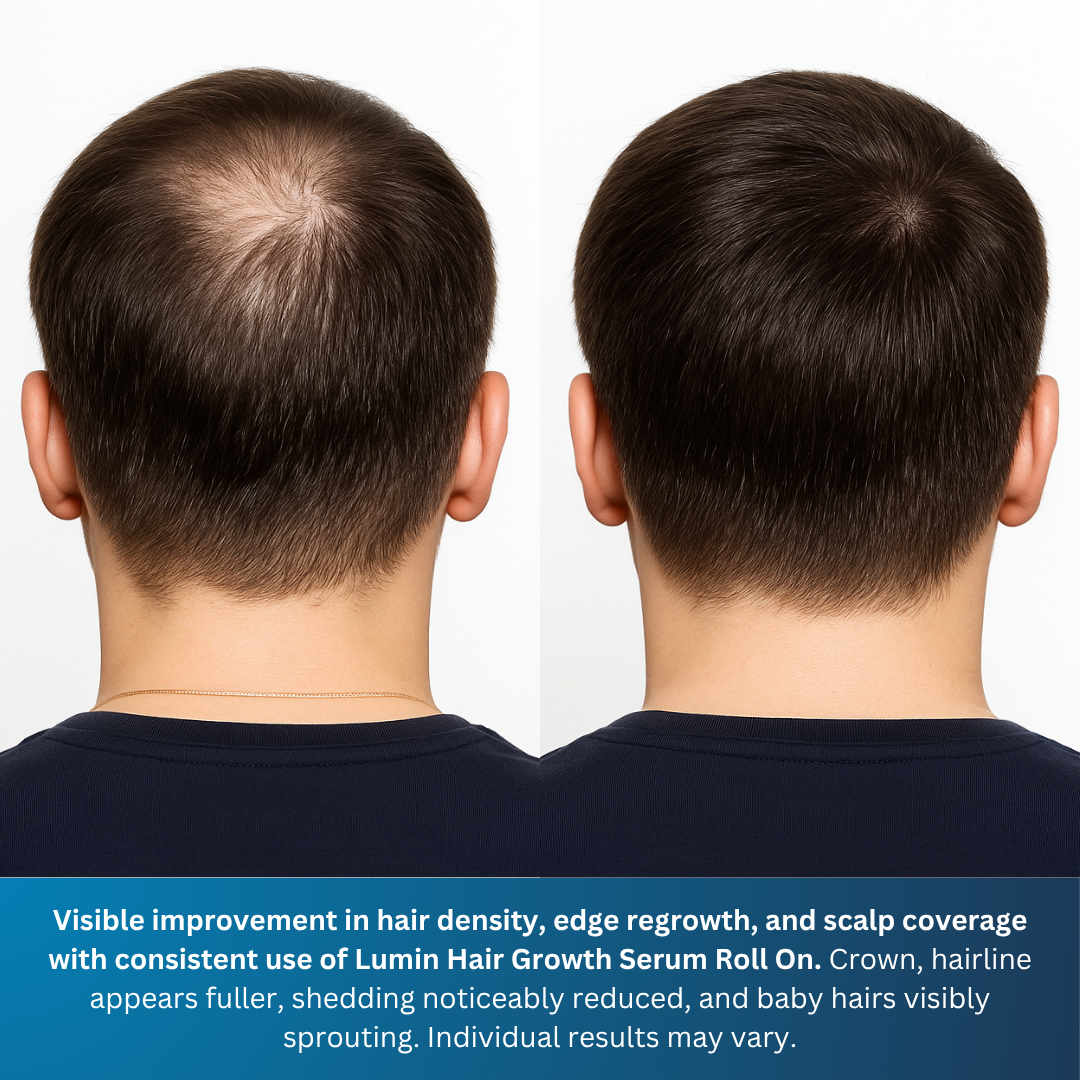 LUMIN - Hair Growth Serum Roll On