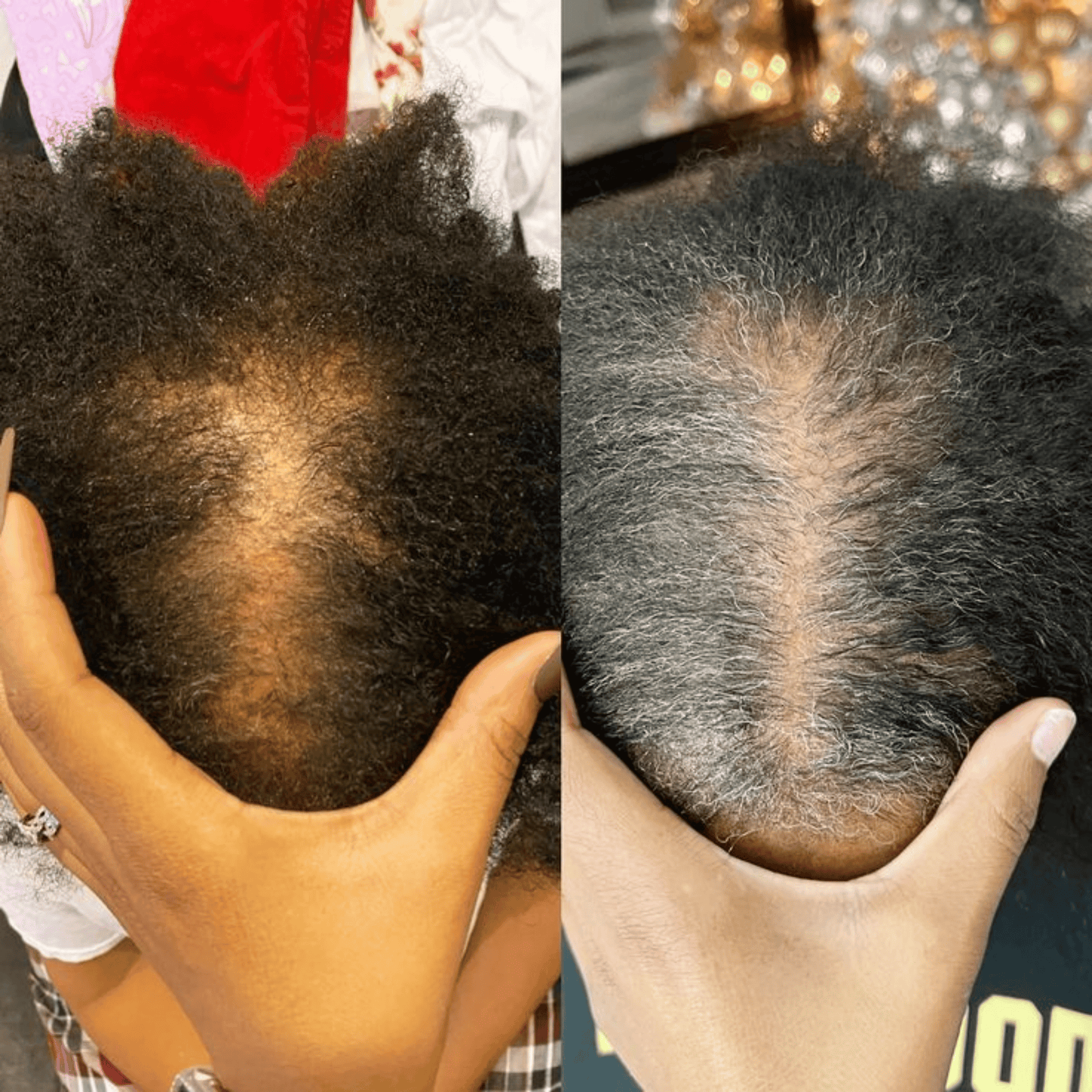 LUMIN - RRB Hair Growth Gummies