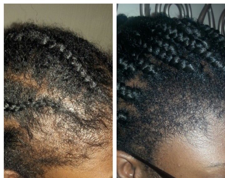 LUMIN - RRB Hair Growth Gummies