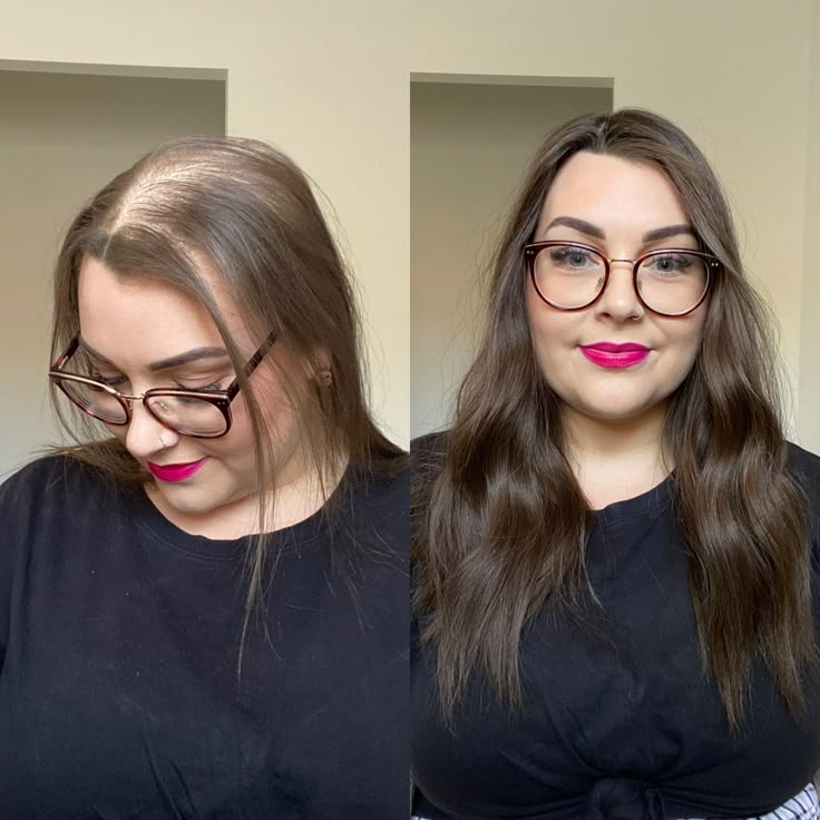 LUMIN - RRB Hair Growth Gummies