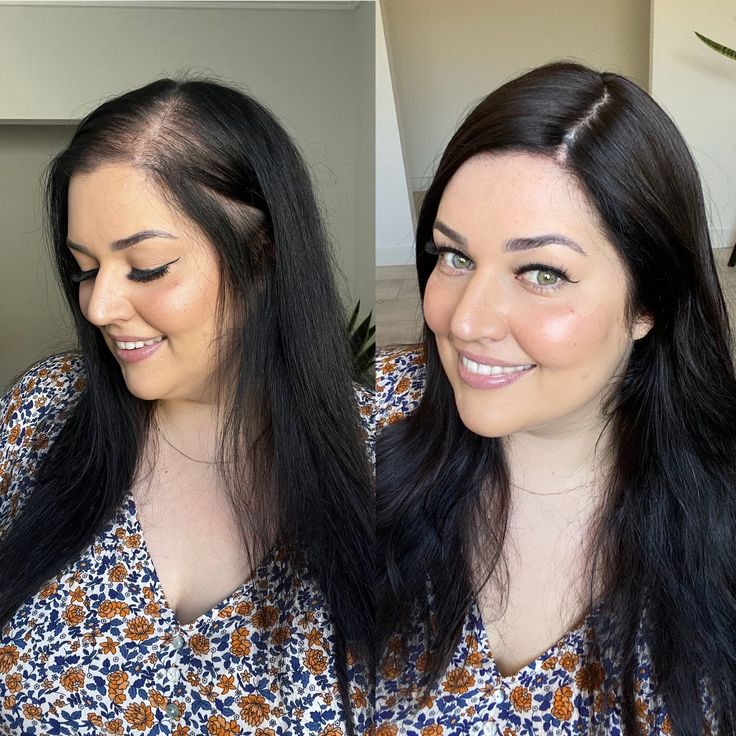 LUMIN - RRB Hair Growth Gummies