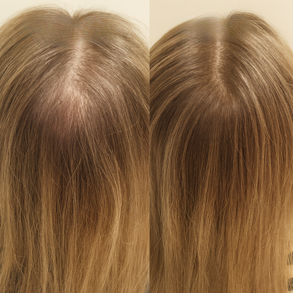 LUMIN - Hair Growth Serum Roll On