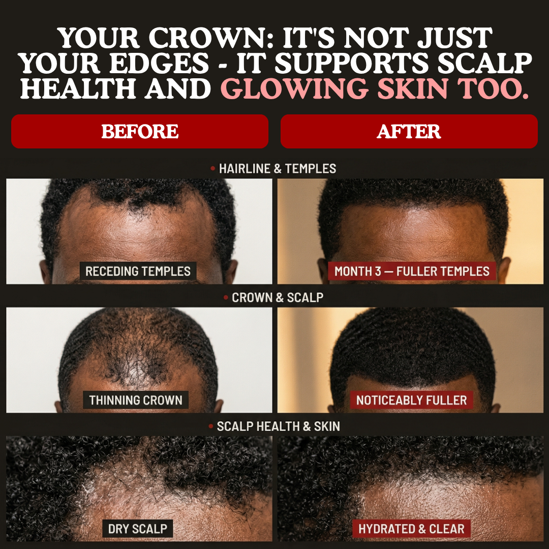 LUMIN - RRB Hair Growth Gummies
