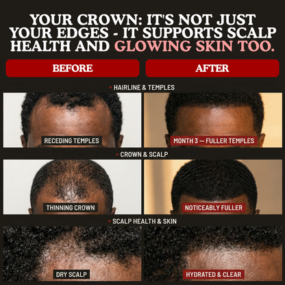 LUMIN - RRB Hair Growth Gummies