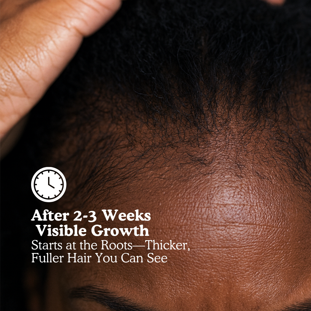 LUMIN - RRB Hair Growth Gummies