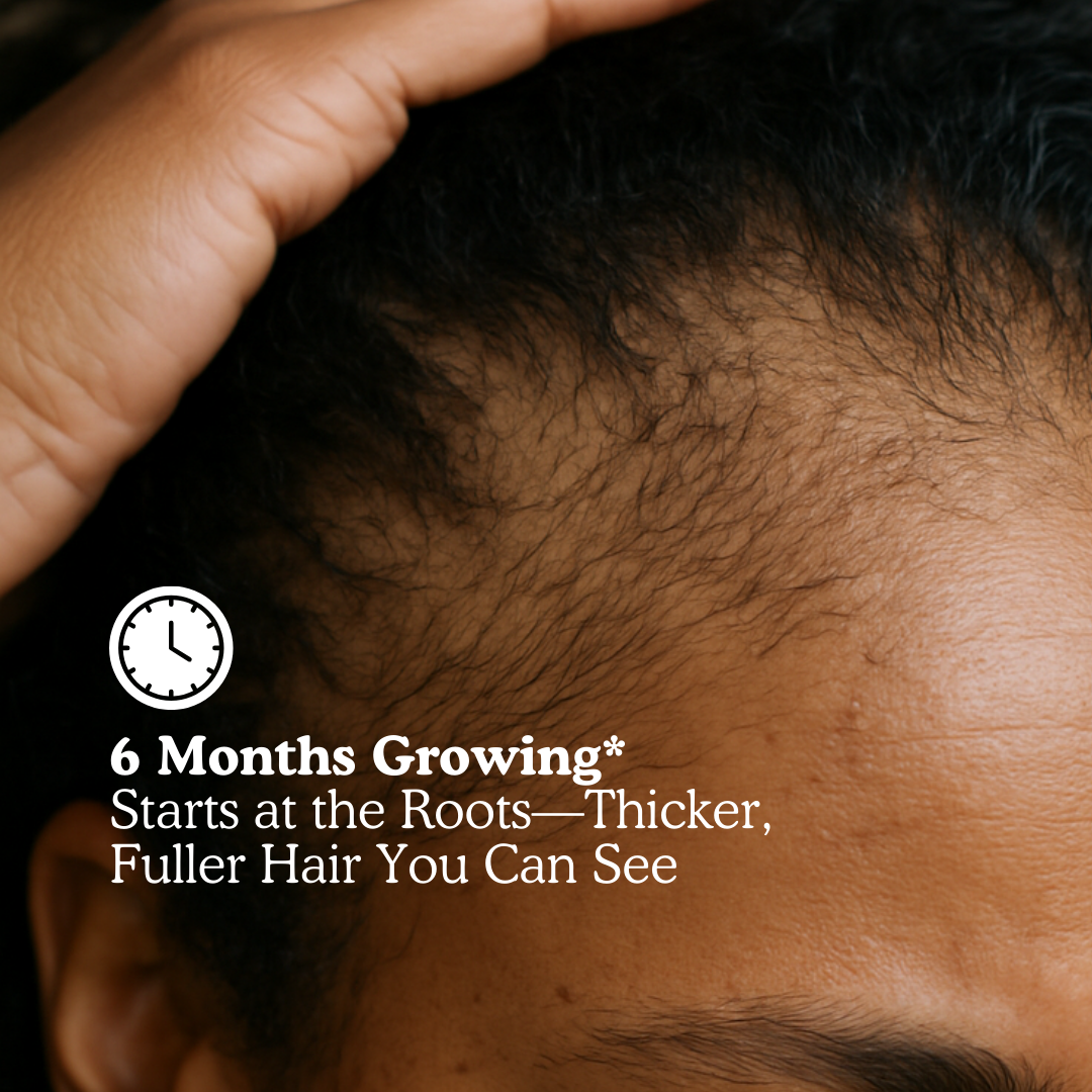 LUMIN - RRB Hair Growth Gummies