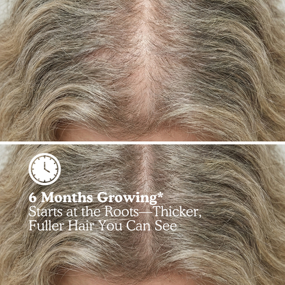 LUMIN - Hair Growth Gummies