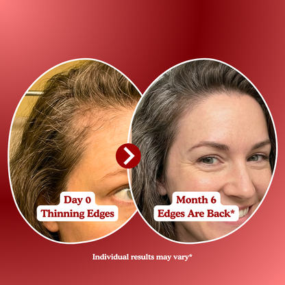 LUMIN - Hair Growth Gummies