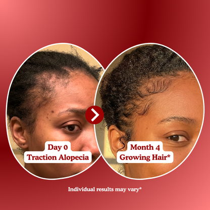 LUMIN - RRB Hair Growth Gummies