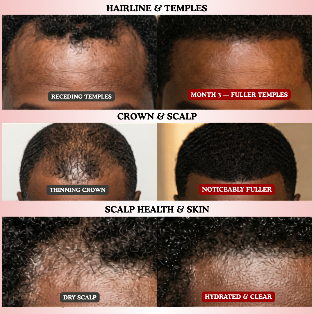 LUMIN - RRB Hair Growth Gummies VIP