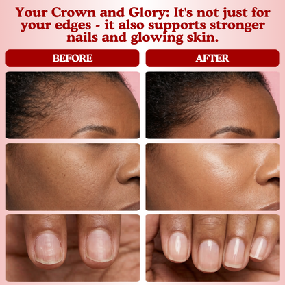 LUMIN - RRB Hair Growth Gummies