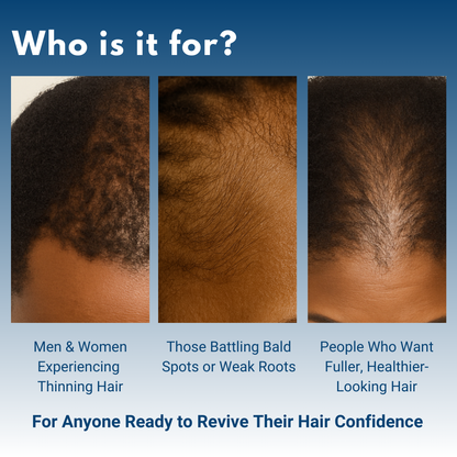 LUMIN - Hair Growth Serum Roll On