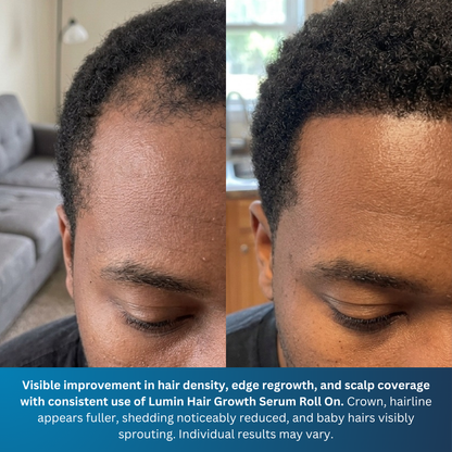 LUMIN - Hair Growth Serum Roll On