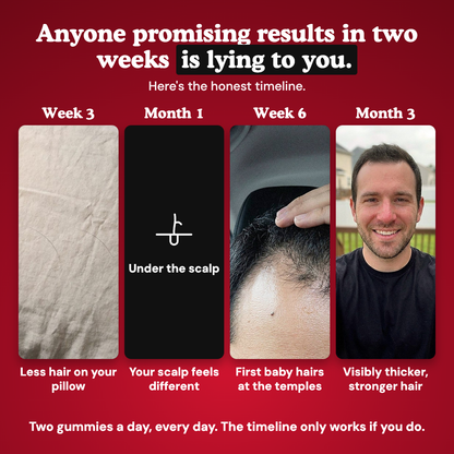 LUMIN - RRB Hair Growth Gummies for men