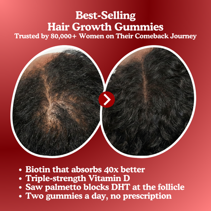 LUMIN - Hair Growth Gummies BOGO