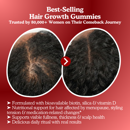 LUMIN - Hair Growth Gummies