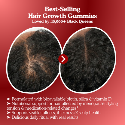 LUMIN - RRB Hair Growth Gummies
