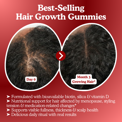 LUMIN - RRB Hair Growth Gummies